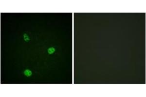 Image no. 1 for anti-Microphthalmia-Associated Transcription Factor (MITF) (AA 151-200) antibody (ABIN1532362)