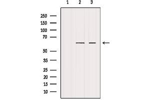 Image no. 2 for anti-Cytochrome P450, Family 4, Subfamily F, Polypeptide 22 (CYP4F22) antibody (ABIN6261204)