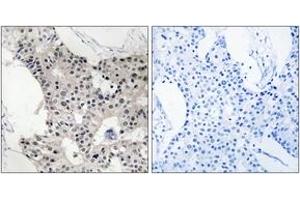 Image no. 1 for anti-B Melanoma Antigen Family, Member 4 (BAGE4) (AA 9-58) antibody (ABIN1534682)