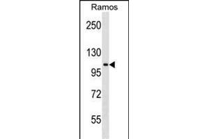 TACC1 antibody  (N-Term)
