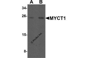 Image no. 1 for anti-Myc Target 1 (MYCT1) (C-Term) antibody (ABIN1077374)