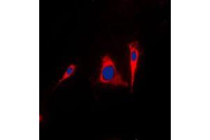 Image no. 1 for anti-14-3-3 gamma (YWHAG1) (Center) antibody (ABIN2705347)