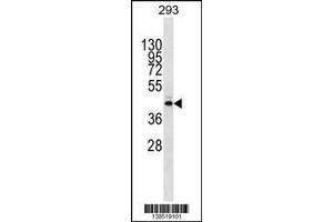 Image no. 1 for anti-Methyltransferase Like 2B (METTL2B) (AA 1-30), (N-Term) antibody (ABIN1538863)