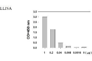 Image no. 6 for Epidermal Growth Factor Receptor (EGFR) ELISA Kit (ABIN625221)
