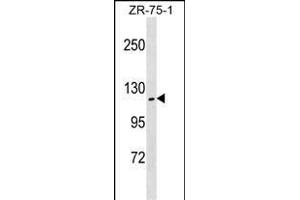ZHX2 Antibody (N-term) (ABIN1538947 and ABIN2850190) western blot analysis in ZR-75-1 cell line lysates (35 μg/lane).