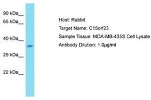 Image no. 1 for anti-Kinetochore-Localized Astrin/SPAG5 Binding Protein (KNSTRN) (AA 31-80) antibody (ABIN6750720)