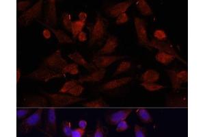 Immunofluorescence analysis of U2OS cells using GPER1 Polyclonal Antibody at dilution of 1:100.