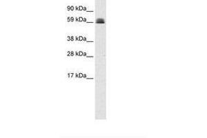 Image no. 1 for anti-Zinc Finger and BTB Domain Containing 45 (ZBTB45) (AA 253-302) antibody (ABIN6735949)