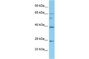 Image no. 4 for anti-Early Growth Response 2 (EGR2) (C-Term) antibody (ABIN2792631)
