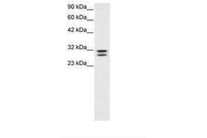Image no. 3 for anti-HIV-1 Tat Interactive Protein 2, 30kDa (HTATIP2) (AA 30-79) antibody (ABIN202114)