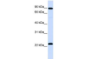 RGS19 Antikörper  (N-Term)
