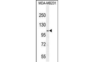anti-Sema Domain, Immunoglobulin Domain (Ig), Short Basic Domain, Secreted, (Semaphorin) 3G (SEMA3G) (AA 216-244) antibody