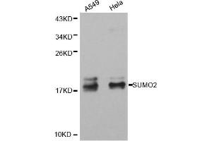 anti-Small Ubiquitin Related Modifier 2 (SUMO2) antibody