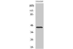 Image no. 1 for anti-Abhydrolase Domain Containing 12 (ABHD12) (Internal Region) antibody (ABIN3183122)