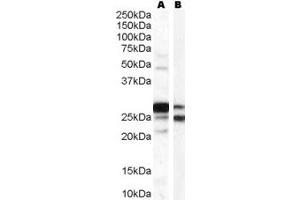 Image no. 5 for anti-Catechol-O-Methyltransferase (COMT) (Internal Region) antibody (ABIN185682)