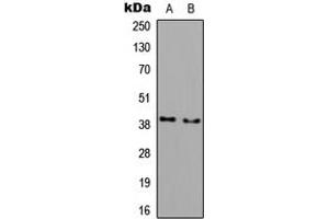 Image no. 1 for anti-Acyl-CoA Wax Alcohol Acyltransferase 1 (AWAT1) (C-Term) antibody (ABIN2704720)
