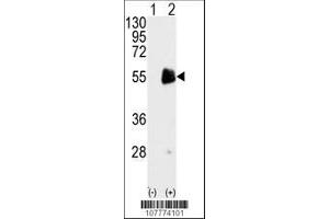 Image no. 1 for anti-Protein Arginine Methyltransferase 7 (PRMT7) (AA 660-692), (C-Term) antibody (ABIN387847)