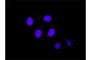 Image no. 2 for IKBKB & CTNNB1 Protein Protein Interaction Antibody Pair (ABIN1339890)