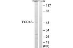 Image no. 1 for anti-Proteasome (Prosome, Macropain) 26S Subunit, Non-ATPase, 12 (PSMD12) (AA 151-200) antibody (ABIN1534504)