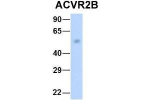 Image no. 5 for anti-Activin A Receptor, Type IIB (ACVR2B) (Middle Region) antibody (ABIN2782110)