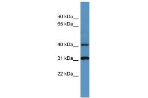 Image no. 2 for anti-Cathepsin D (CTSD) (C-Term) antibody (ABIN2776841)