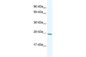 Image no. 1 for anti-General Transcription Factor IIF, Polypeptide 2, 30kDa (GTF2F2) (C-Term) antibody (ABIN2777296)