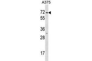 Image no. 1 for anti-Keratin 75 (KRT75) (AA 65-92), (N-Term) antibody (ABIN951826)