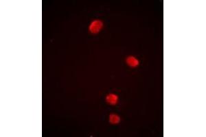 Image no. 1 for anti-Proteasome (Prosome, Macropain) 26S Subunit, Non-ATPase, 13 (PSMD13) antibody (ABIN3198277)