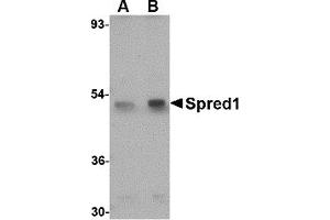 Image no. 1 for anti-Sprouty-Related, EVH1 Domain Containing 1 (SPRED1) (Middle Region 1) antibody (ABIN1031192)
