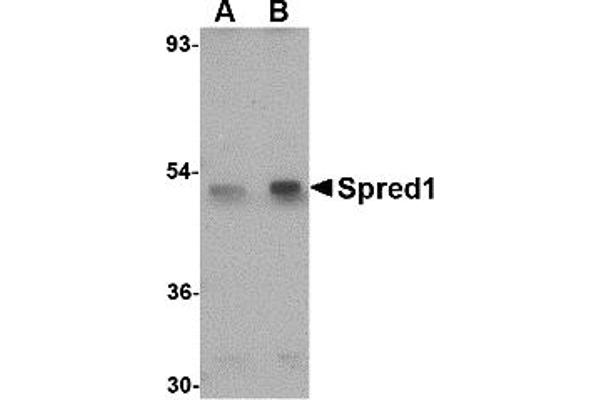 SPRED1 Antikörper  (Middle Region 1)
