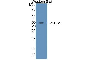 Image no. 1 for anti-ATP-Binding Cassette, Sub-Family D (Ald), Member 4 (ABCD4) (AA 356-606) antibody (ABIN5013196)