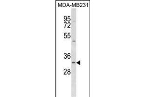 FAHD2B antibody  (C-Term)