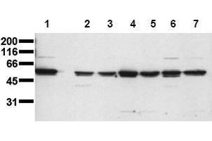 Image no. 1 for anti-V-Yes-1 Yamaguchi Sarcoma Viral Oncogene Homolog 1 (YES1) (N-Term) antibody (ABIN126915)