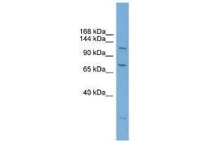 Image no. 1 for anti-Poly (ADP-Ribose) Polymerase Family, Member 10 (PARP10) (N-Term) antibody (ABIN2775587)