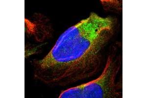 Image no. 1 for anti-Ral GTPase Activating Protein, alpha Subunit 1 (Catalytic) (RALGAPA1) antibody (ABIN5586749)