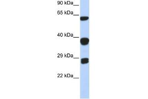 Image no. 1 for anti-Small Nuclear Ribonucleoprotein Polypeptides B and B1 (SNRPB) (Middle Region) antibody (ABIN633287)