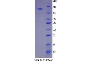 Image no. 1 for Ribophorin 1 (RPN1) (AA 273-518) protein (His tag,GST tag) (ABIN1878288)