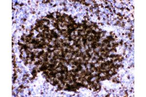 Image no. 3 for anti-Fc Fragment of IgE, Low Affinity II, Receptor For (CD23) (FCER2) (AA 50-331) antibody (ABIN3043829)