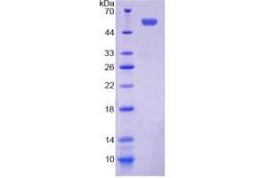 Image no. 2 for Transmembrane Protein 27 (TMEM27) ELISA Kit (ABIN6720600)