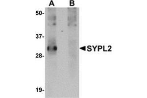 Image no. 2 for anti-Synaptophysin-Like 2 (SYPL2) (C-Term) antibody (ABIN500857)