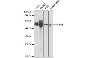 Image no. 2 for anti-N-Myc Downstream Regulated 1 (NDRG1) antibody (ABIN3023026)