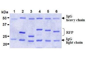 Image no. 2 for anti-Red Fluorescent Protein (RFP) antibody (Agarose Beads) (ABIN1449297)