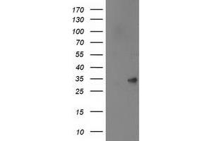 Image no. 4 for anti-Sepiapterin Reductase (SPR) antibody (ABIN1501111)
