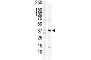 Image no. 1 for anti-Calcium/calmodulin-Dependent Protein Kinase I (CAMK1) antibody (ABIN3003045)