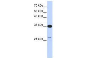 Image no. 1 for anti-TP53 Target 5 (TP53TG5) (AA 143-192) antibody (ABIN6741254)