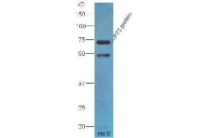 Image no. 3 for anti-Tumor Protein P73 (TP73) (AA 501-631) antibody (ABIN675279)