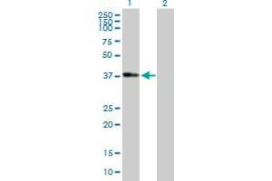 Image no. 2 for anti-Alcohol Dehydrogenase 1B (Class I), beta Polypeptide (ADH1B) (AA 1-375) antibody (ABIN513125)