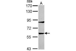 Image no. 3 for anti-Tyrosine Hydroxylase (TH) (Center) antibody (ABIN2855393)