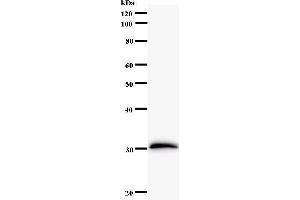 Image no. 1 for anti-Forkhead Box L2 (FOXL2) antibody (ABIN931144)
