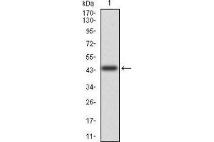 Image no. 3 for anti-CD6 (CD6) (AA 18-199) antibody (ABIN5542301)